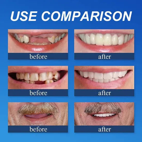 ⏰Ends Today: 70% OFF! 🌎LUMIVO™ Custom-Fit Dentures— Designed for Comfort and a Natural-Looking Smile