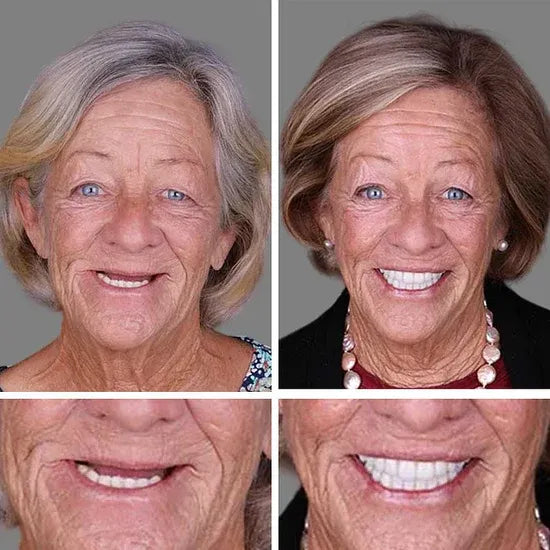 ⏰Ends Today: 70% OFF! 🌎LUMIVO™ Custom-Fit Dentures— Designed for Comfort and a Natural-Looking Smile